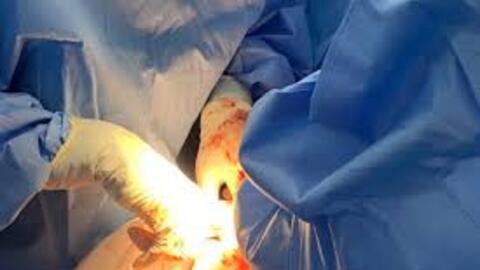 Phẫu thuật thành công u buồng trứng xoắn cho thai phụ 34 tuần