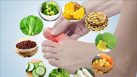 Những thực phẩm giúp giảm đau gout nhanh bạn cần biết