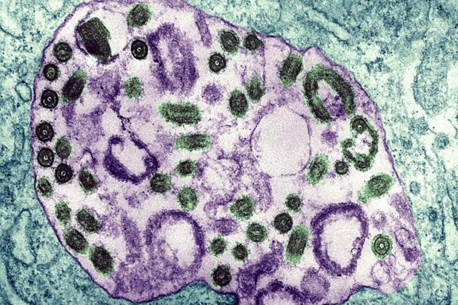 Đã có 9 người chết liên quan đến virus Marburg: Các chuyên gia nói gì về dịch bệnh với tỷ lệ tử vong lên tới 88%? - Ảnh 4.