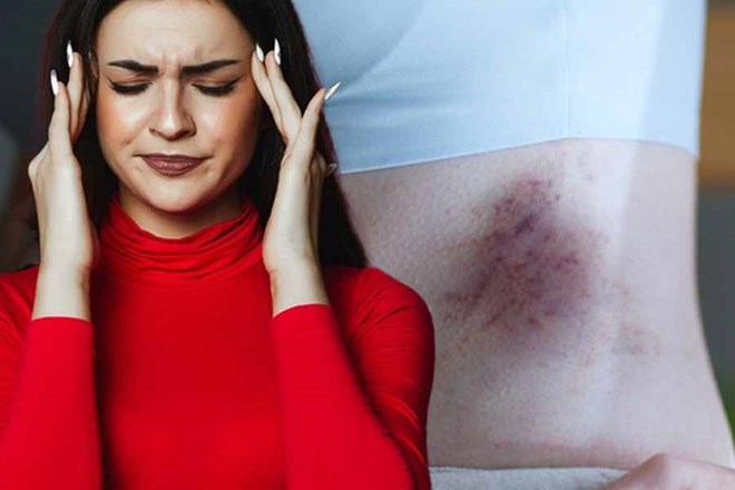 Cách phát hiện và điều trị chảy máu bên trong