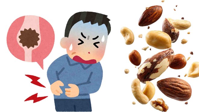 Loại hạt người cao tuổi ăn nhiều có thể gây hại cho thận